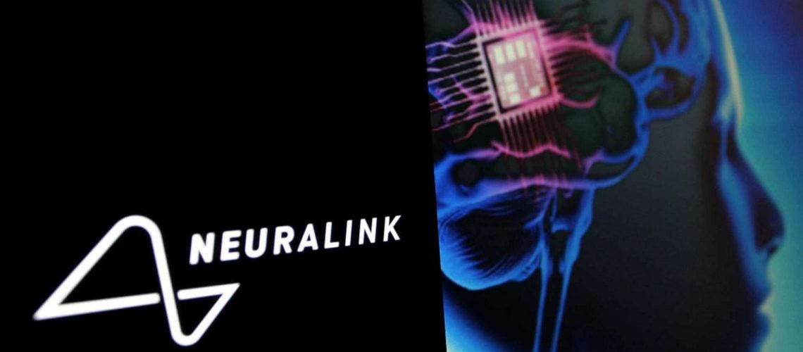 2025-02-07 - neuralink-1-1920x1080